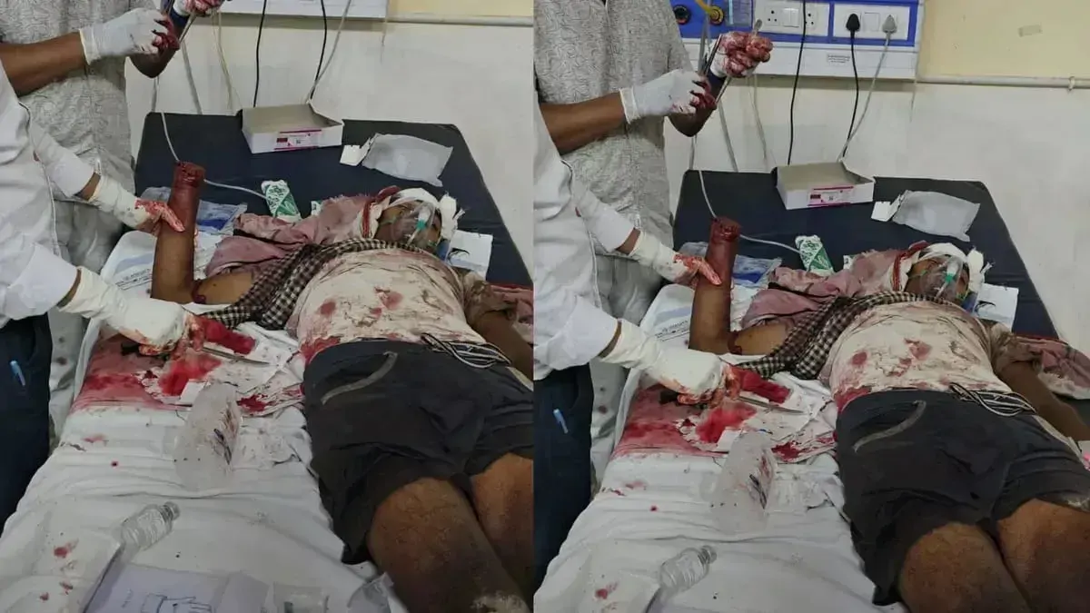 दरभंगा में दिनदहाड़े जोरदार बम विस्फोट! दो युवक गंभीर रूप से घायल; इलाके में दहशत